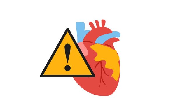 Coronary artery disease medical illustration. Heart blockage and atherosclerosis animation
