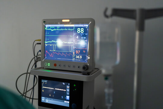 Veterinary hospital showing vital signs monitoring during surgery