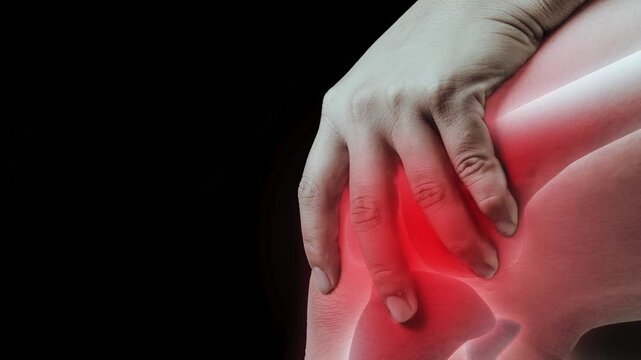 Knee Pain Affecting Mobility and Daily Activities. Knee injury with dislocation and sprains. Pain and edema in the sprained Knee.