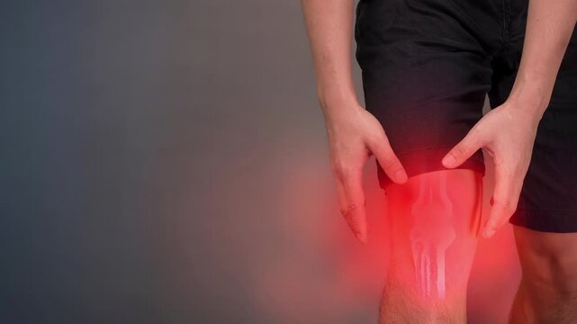 Knee Pain Affecting Mobility and Daily Activities. Knee injury with dislocation and sprains. Pain and edema in the sprained Knee.