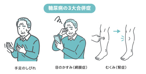 糖尿病の三大合併症（しめじ）の症状イラストセット【高齢男性版】（しびれ・網膜症・腎症）