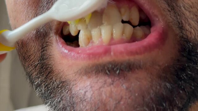 Man brushing unhealthy teeth and gums with toothbrush and toothpaste. Smiling beared guy enjoying morning oral anticavity hygienic routine alone in bathroom. Brush your teeth for your health.