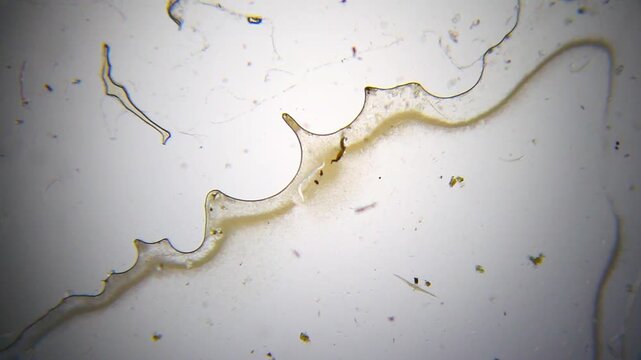 Nematode surrounded by a dense swarm of living bacteria under 40x brightfield microscopy. Detailed 4K scientific stock footage of intense microbial activity.