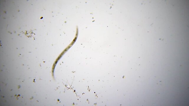 Fast-moving nematode with visible internal eggs under 40x brightfield microscopy. Detailed 4K scientific stock footage of active parasitic worm behavior.