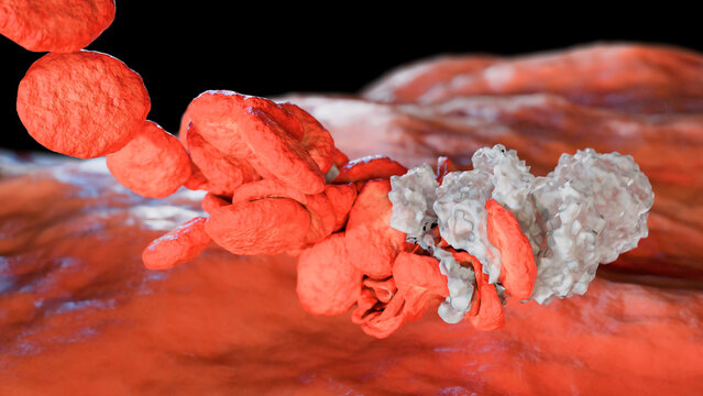Formation of a blood clot, blocked blood, Clot in blood vessels, arteries and capillaries, 3D animation 4k high resolution 3d render