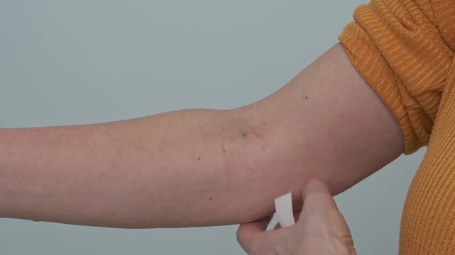 A woman removes a white bandage from her arm after a blood test or blood donation and examines and shows the puncture site and marks. Health check and blood donation concept.