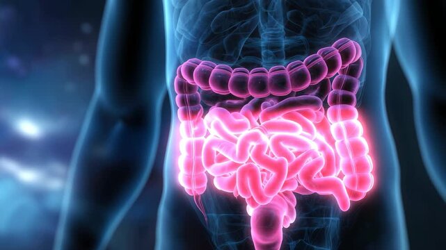 Medical animation showing a man's intestines affected by Crohn's disease with a focus on inflammation and structural changes in the digestive system