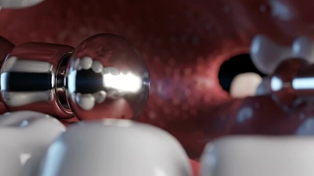 Dental Implants and Orthodontic Braces Closeup.
