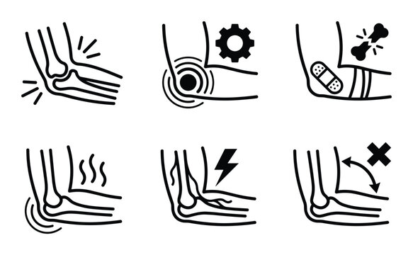Elbow injury line art vector icons set, bone fracture, dislocation, pain, inflammation, and joint problems illustrations