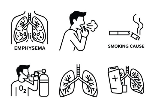 Illustration of emphysema causes, symptoms, and treatments including smoking, oxygen therapy, and medical interventions