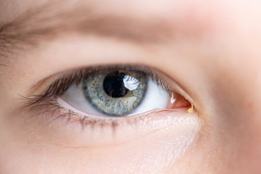 Close-up: Light gray eye of teenage girl. High quality photo