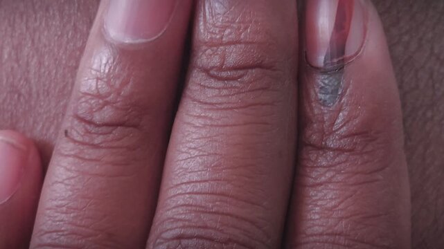 A fleeting moment of civic duty, forever stamped in ink. This potent mark of silver nitrate ensures a fair election, a badge of a voter's choice that only time and skin renewal can erase.