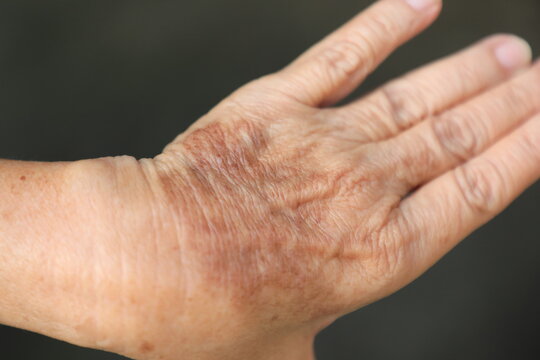 ging hands aging hands aging hands showing wrinkles and age spots, elderly hands, senior skin texture, aging process, healthcare and aging society concept