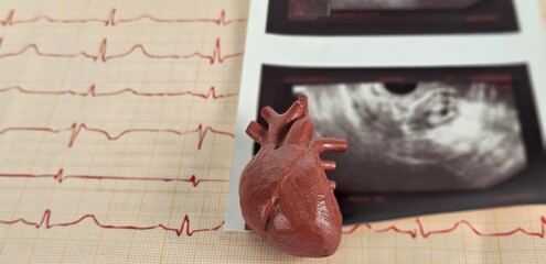 Medical study material with a model heart, ECG readings, and ultrasound images on a clinical