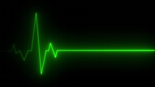 ECG heartbeat monitor green line animation video