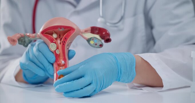 Medical gynecologist demonstration of yellow pills capsule with omega, vitamin for health with women reproductive system model in clinical setting.