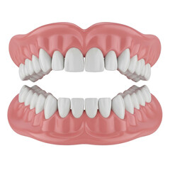 Obraz premium An illustration of a person's upper and lower dental arches with teeth alignment