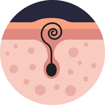 Folliculitis &ndash; Irritated hair follicles shown as small red bumps on the skin, often appearing after shaving or waxing.