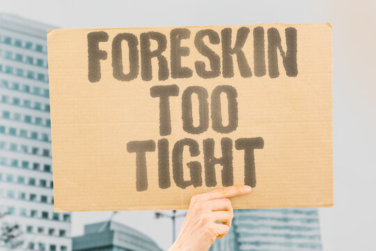 "Foreskin Too Tight" Phimosis causes retraction difficulty. PHIMOSIS. CAUSES. RETRACTION. DIFFICULTY. FORESKIN.