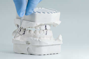 Dental check on full plaster teeth model © Maximusdn