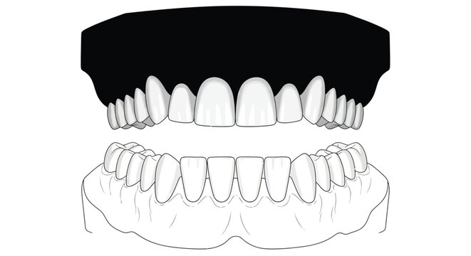 Illustration of human teeth showing upper and lower dentition