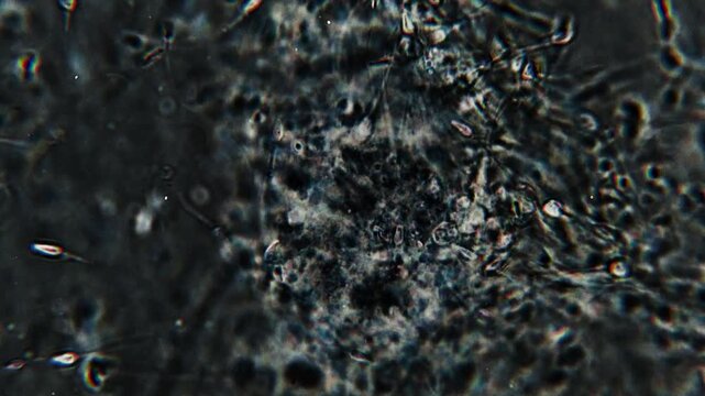 Real footage of human sperm under a light microscope 100x fertilizing an egg cell moving fast dark field microscope 4K HQ 