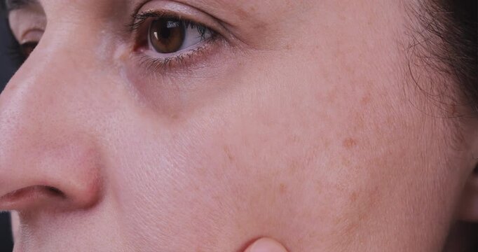 Adult woman highlighting age spots on her face, representing skincare, anti-aging, collagen loss, sun damage, and beauty care concepts.