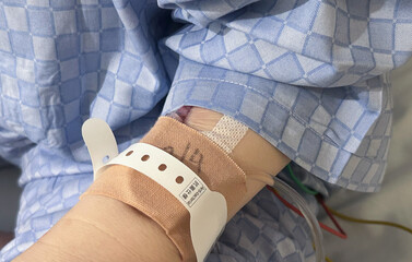 腫れている点滴中の腕