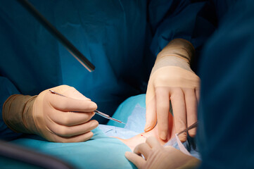 Cosmetic Surgery Procedure with Scalpel and Precision Hands
