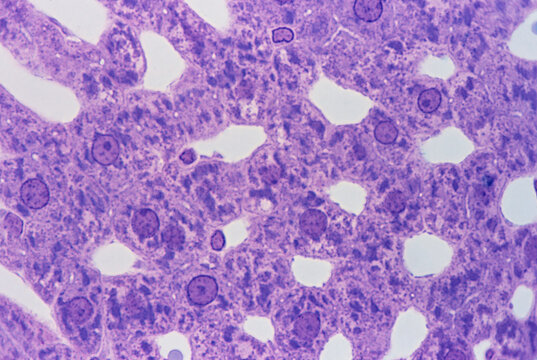 Hepatocytes. Basophilic or Berg clumps
