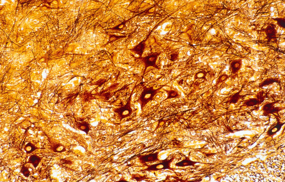Multipolar neurons. Silver stain