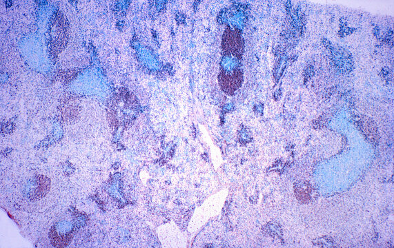 Human spleen. B lymphocytes