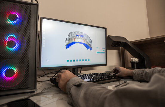 Dental CAD software showing 3D crown model on screen, digital dentistry, orthodontic planning, prosthetics design process in modern dental laboratory.