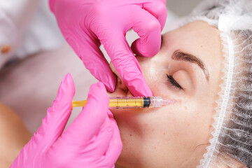 Under eye injection procedure for dark circles and puffiness correction