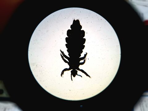Microscopic silhouette of a head louse (Pediculus humanus capitis) under brightfield illumination. Detailed view of the insect's anatomy, including legs and segmented body. High magnification for para