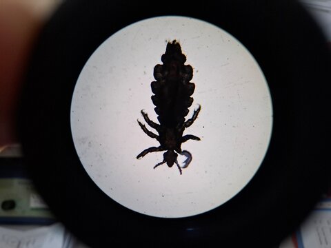 Microscopic silhouette of a head louse (Pediculus humanus capitis) under brightfield illumination. Detailed view of the insect's anatomy, including legs and segmented body. High magnification for para
