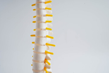 Spinal nerve and bone, Lumbar spine displaced herniated disc fragment, Model for treatment medical in the orthopedic department.