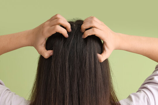 Young woman with dandruff problem scratching head on green background, back view