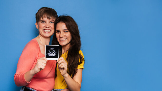two women presenting a baby scan toward the camera. Copy space