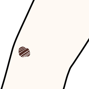 Scar illustration
瘡蓋 イラスト