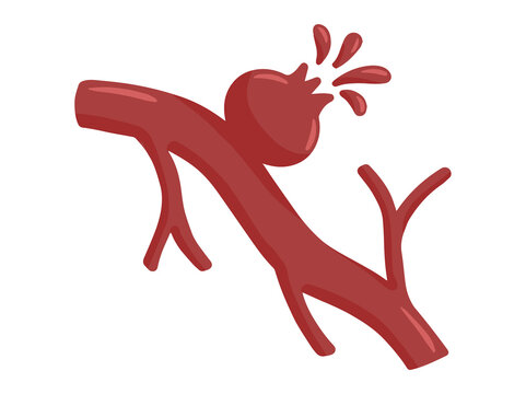Ruptured Aneurysm Blood Vessel Clip Art
