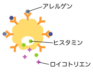 肥満細胞　アレルゲンとlgE抗体が結合して、ヒスタミンやロイコトリエンが排出される