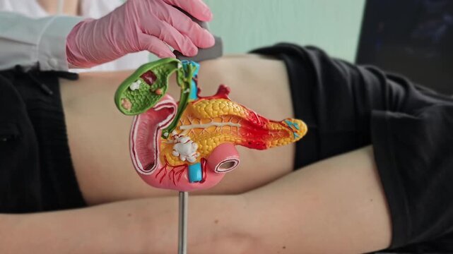 Anatomical model of the pancreas, duodenum, and spleen, as well as an ultrasound scan. Abdominal ultrasound