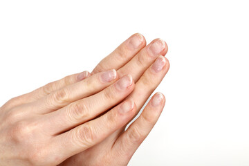 Damaged fingernails after gel polish removal