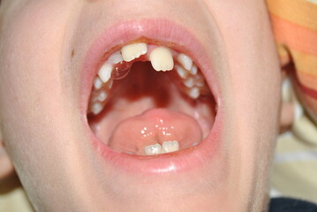 close up of a young woman smiling