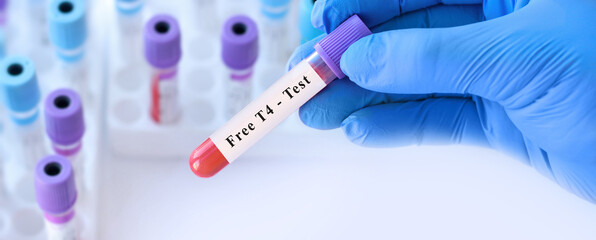 Fototapeta premium Doctor holding free T4 blood test tube explaining evaluation of active thyroxine hormone levels, thyroid function regulation and diagnosis of thyroid disorders in clinical laboratory diagnostics