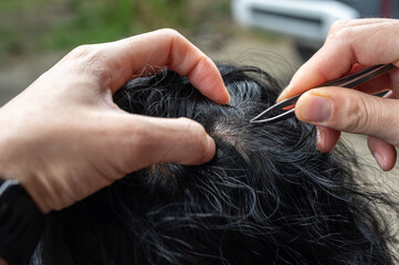 Obraz premium Cropped shot view of someone using a tweezers for gripping and plucking gray hair from woman head. Repeated plucking can damage the hair follicle and potentially cause the hair to thin.