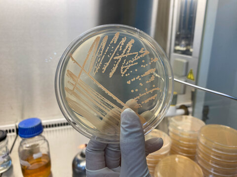 Bacterial colony growth on agar plate in laboratory. Macro shot of colorful microbial colonies on Petri dish. Bacillus is colony.