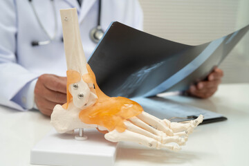 Doctor examining foot ankle  joint bone radiography xray film.