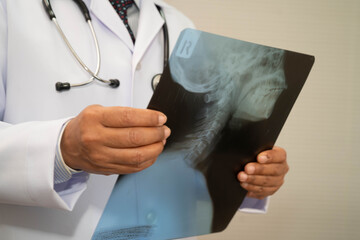 Doctor examining cervical vertebrae bone radiography xray film.